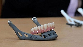 Кости будут печатать на 3D-принтере