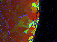 Разработан новый способ восстановления тканей