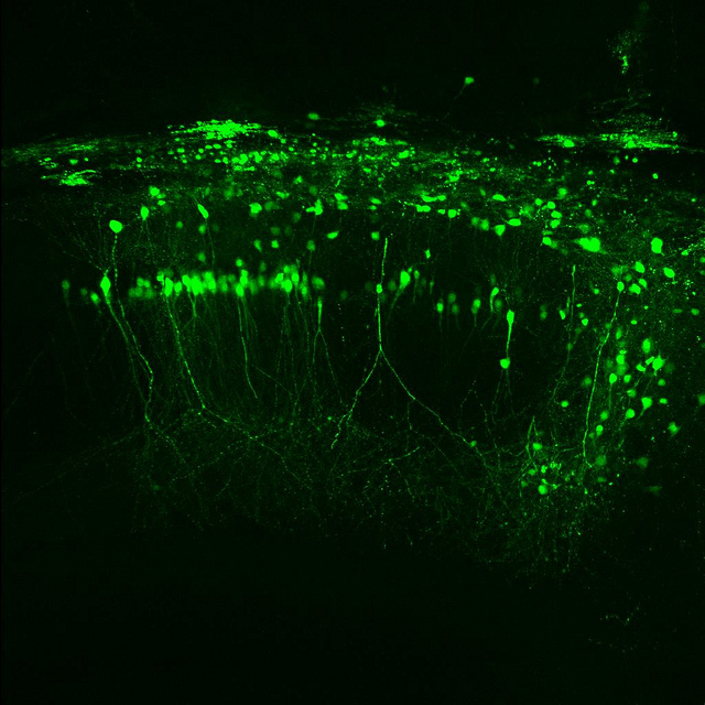 Как защитить мозг при кислородном голодании?