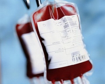 Переливание крови вызывает аллергию