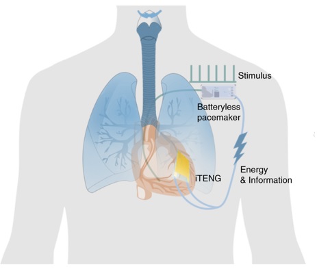 Продолжаются разработки автономного кардиостимулятора