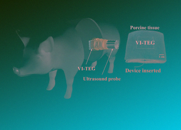 Разработан имплантат способный получать энергию из ультразвука