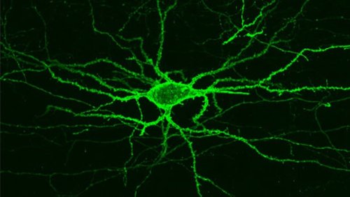 Новая технология съемки позволяет увидеть электрическую деятельность тканей головного мозга