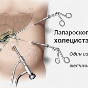 Кафедра «МиМ» провела научный семинар по математическому моделированию в области медицины