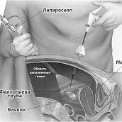 Кафедра «Математика и моделирование» провела научный семинар по математическому моделированию в медицине