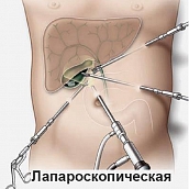 Кафедра «Математика и моделирование» провела научный семинар по математическому моделированию в медицине
