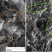 Ученые СГТУ разработали способ, который продлит срок службы титановых имплантов
